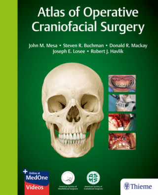 Kniha Atlas of Operative Craniofacial Surgery Steven R. Buchman
