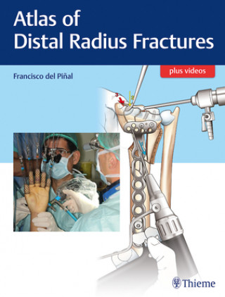 Kniha Atlas of Distal Radius Fractures Francisco Del Pinal