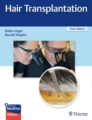 Livre Hair Transplantation Robin Unger