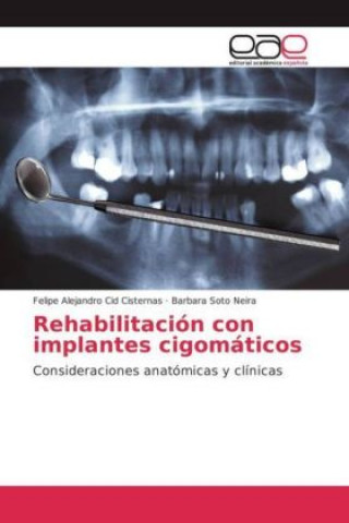 Carte Rehabilitación con implantes cigomáticos Felipe Alejandro Cid Cisternas