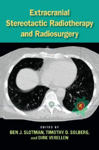 Carte Extracranial Stereotactic Radiotherapy and Radiosurgery Ben J. Slotman