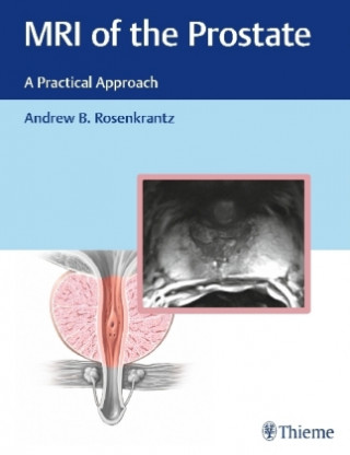 Könyv MRI of the Prostate Andrew Rosenkrantz