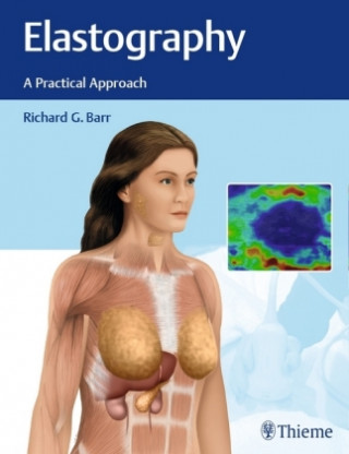 Kniha Elastography Richard G. Barr