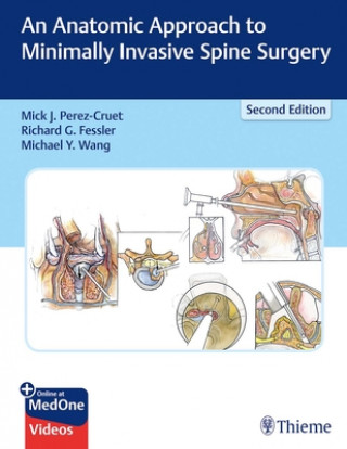 Kniha Anatomic Approach to Minimally Invasive Spine Surgery J. Mick Perez-Cruet