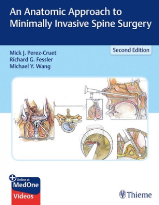 Книга Anatomic Approach to Minimally Invasive Spine Surgery J. Mick Perez-Cruet