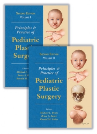 Книга Principles and Practice of Pediatric Plastic Surgery Michael Bentz