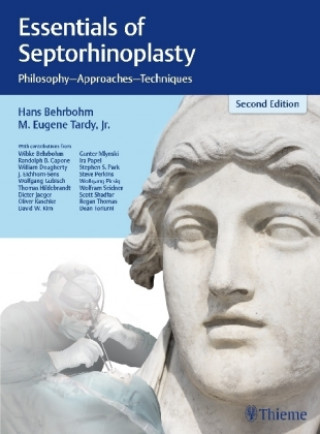 Kniha Essentials of Septorhinoplasty Hans Behrbohm