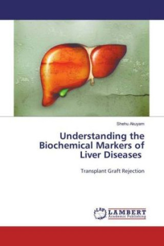 Könyv Understanding the Biochemical Markers of Liver Diseases Shehu Akuyam