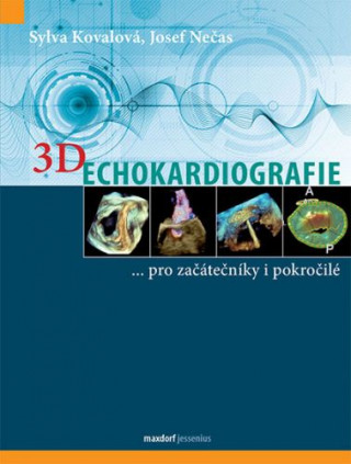 Книга 3D Echokardiografie Sylva Kovalová