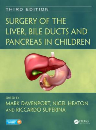 Książka Surgery of the Liver, Bile Ducts and Pancreas in Children Mark Davenport