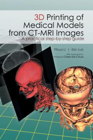 Kniha 3D Printing of Medical Models from CT-MRI Images Li Yihua