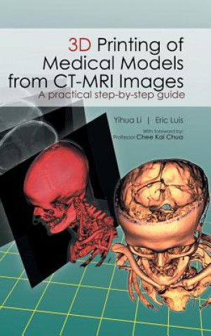 Könyv 3D Printing of Medical Models from CT-MRI Images Li Yihua