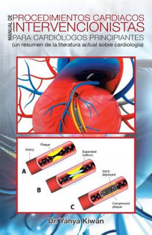 Könyv Manual de Procedimientos Cardiacos Intervencionistas Para Cardiologos Principiantes Dr Yahya Kiwan