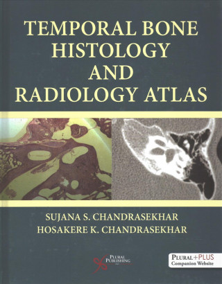Kniha Temporal Bone Histology and Radiology Atlas Sujana S. Chandrasekhar