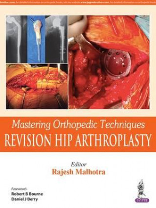 Carte Mastering Orthopedic Techniques: Revision Total Hip Arthroplasty Rajesh Malhotra