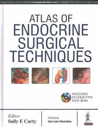 Knjiga Atlas of Endocrine Surgical Techniques Sally E. Carty