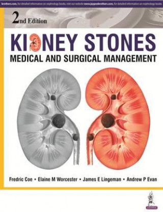 Carte Kidney Stones Fredric Coe