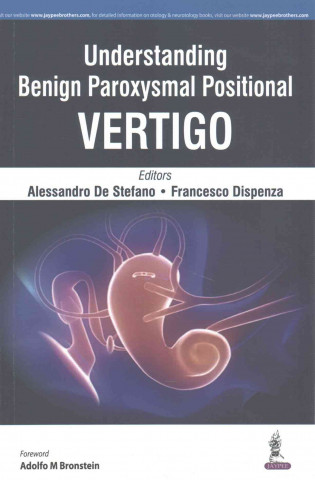 Книга Understanding Benign Paroxysmal Positional Vertigo Francesco Dispenza