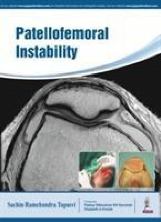 Kniha Patellofemoral Instability Sachin Tapasvi