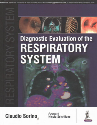 Kniha Diagnostic Evaluation of the Respiratory System Sorino Claudio