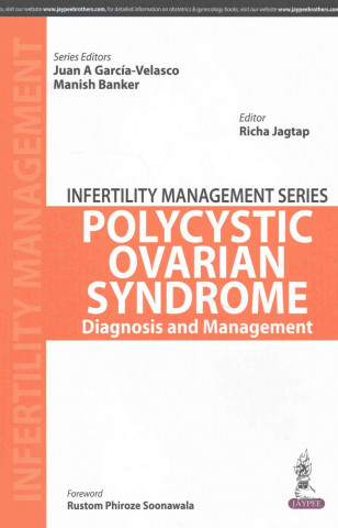 Kniha Infertility Management Series: Polycystic Ovaries Manish Banker