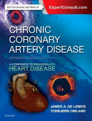 Kniha Chronic Coronary Artery Disease James Delemos