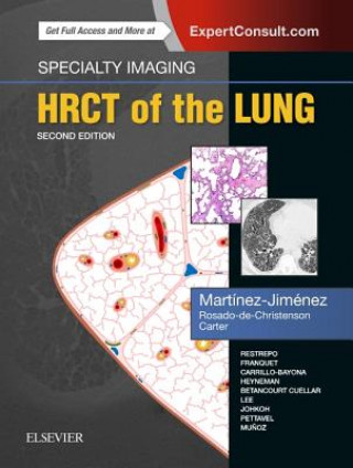 Kniha Specialty Imaging: HRCT of the Lung Santiago Martinez-Jimenez