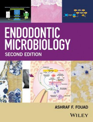 Kniha Endodontic Microbiology 2e Ashraf F. Fouad