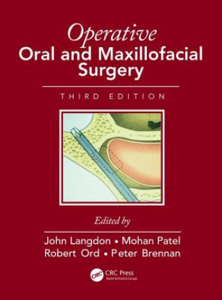 Kniha Operative Oral and Maxillofacial Surgery 