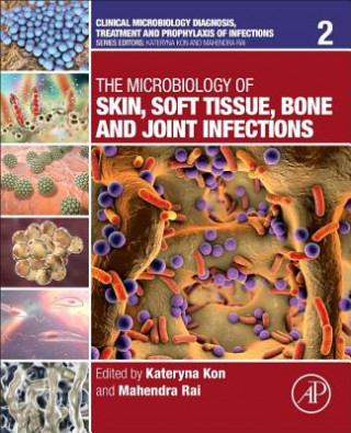 Knjiga Microbiology of Skin, Soft Tissue, Bone and Joint Infections Katheryna Kon