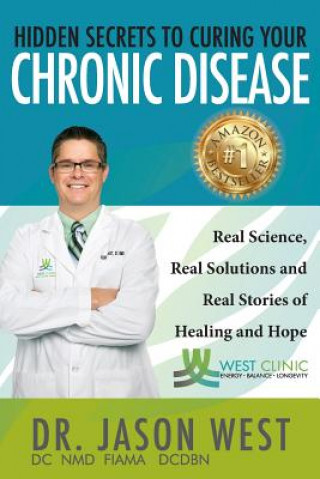 Buch HIDDEN SECRETS TO CURING YOUR Jason West