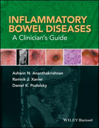 Książka Inflammatory Bowel Diseases Daniel K. Podolsky