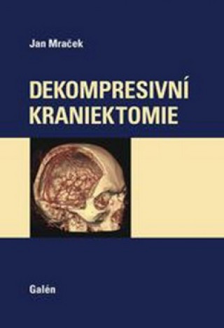 Könyv Dekompresivní kraniektomie Jan Mraček