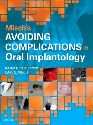 Kniha Misch's Avoiding Complications in Oral Implantology Carl E. Misch