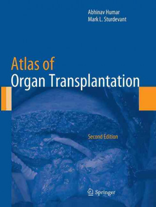 Kniha Atlas of Organ Transplantation Abhinav Humar