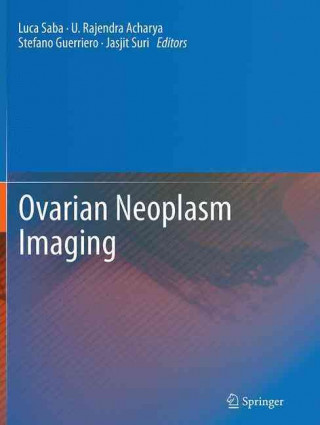 Kniha Ovarian Neoplasm Imaging Luca Saba