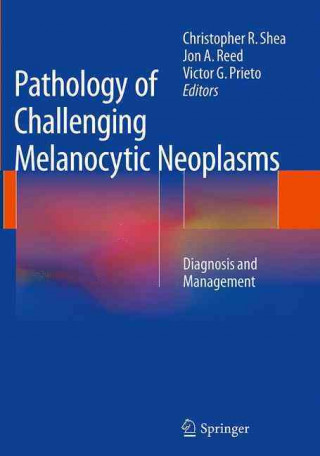 Kniha Pathology of Challenging Melanocytic Neoplasms Christopher R. Shea