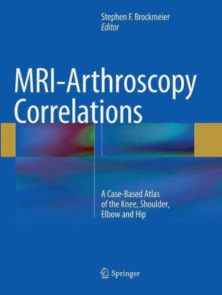 Kniha MRI-Arthroscopy Correlations Stephen F. Brockmeier