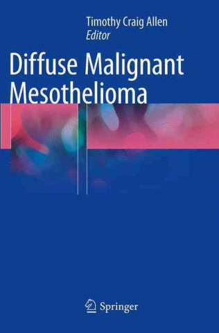 Boek Diffuse Malignant Mesothelioma Timothy Craig Allen