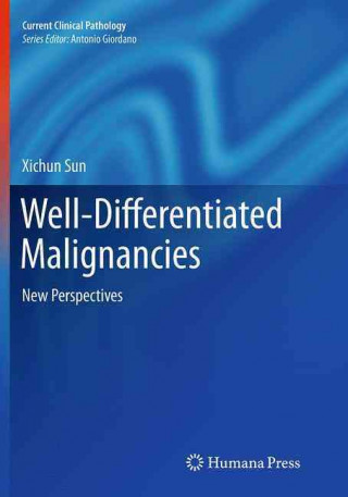 Kniha Well-Differentiated Malignancies Xichun Sun