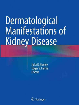 Könyv Dermatological Manifestations of Kidney Disease Julia R. Nunley