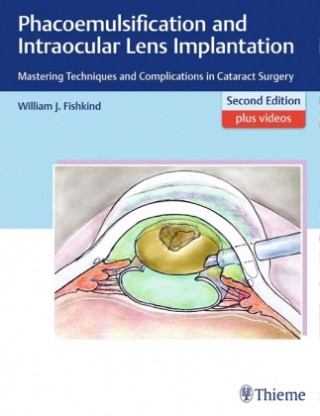 Könyv Phacoemulsification and Intraocular Lens Implantation William J. Fishkind