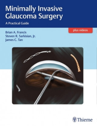 Книга Minimally Invasive Glaucoma Surgery Brian Francis