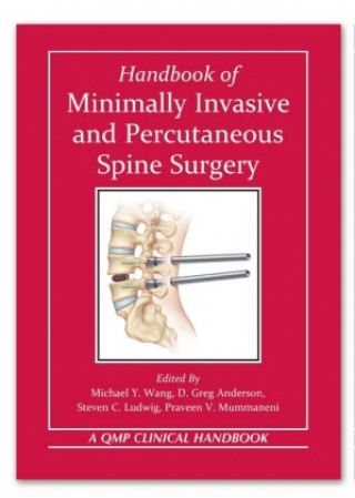 Kniha Handbook of Minimally Invasive and Percutaneous Spine Surgery Michael Wang