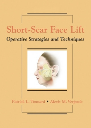 Kniha Short-Scar Face Lift Tonnard