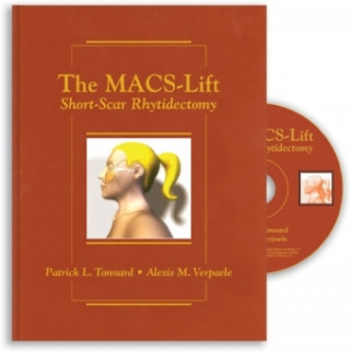 Kniha MACS-Lift Tonnard