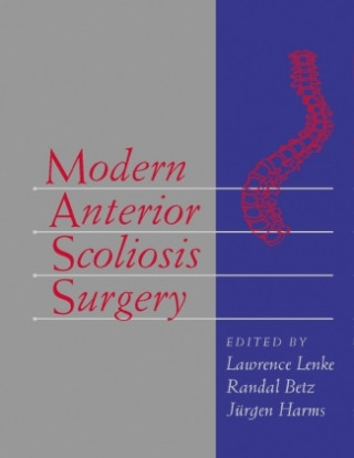 Kniha Modern Anterior Scoliosis Surgery Lawrence Lenke