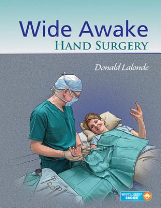 Könyv Wide Awake Hand Surgery Donald Lalonde