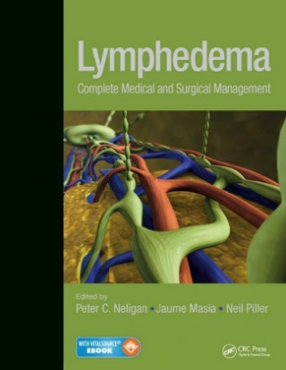 Kniha Lymphedema Peter C. Neligan