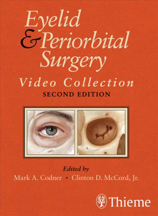 Digital Eyelid and Periorbital Surgery Video Collection. USB-Stick Mark Codner